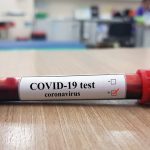 tampone-covid-19-coronavirus-shutt